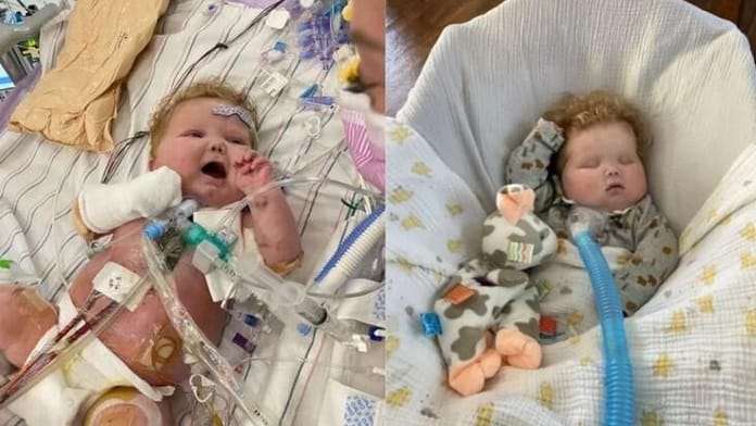 Baby Makes Medical History With First Heart And Thymus Transplant - The ...