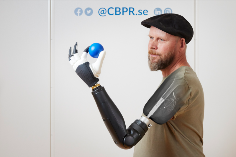 Tonney-prosthetic-arm