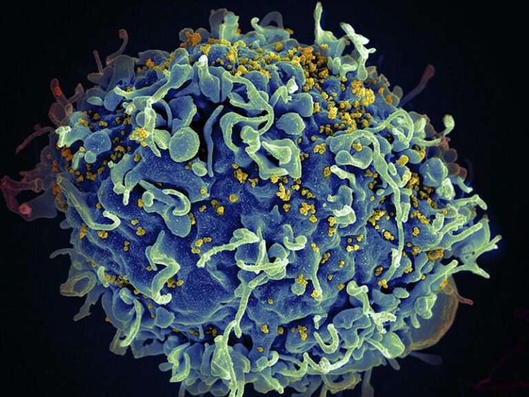 Patient is cured of HIV by own immune system