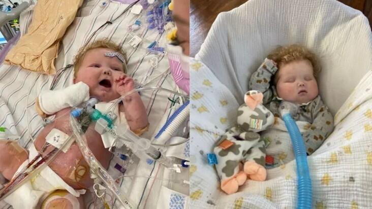 Baby makes medical history with first heart and thymus transplant